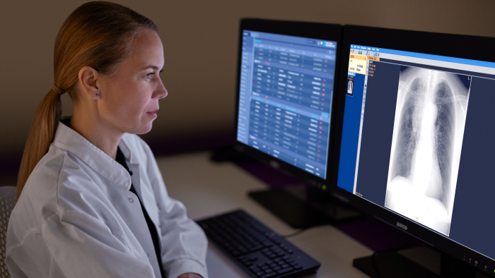 Lung cancer screening made smarter &ndash; Combining Leading Technology and AI